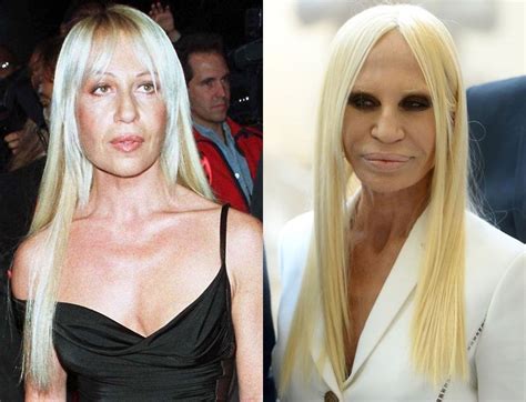 versace donatella face|donatella versace before and after.